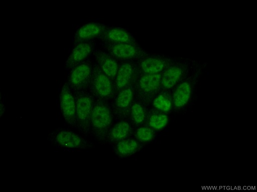 [17452-1-AP-150UL] PPIL6 Polyclonal antibody