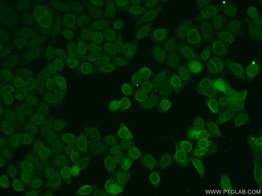 [17455-1-AP-150UL] TMEM120A Polyclonal antibody