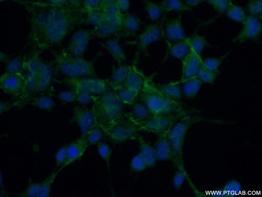 [17458-1-AP-20UL] RTKN2 Polyclonal antibody