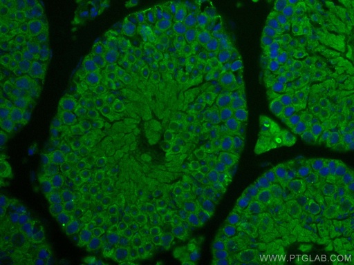 [17460-1-AP-20UL] IFT140 Polyclonal antibody