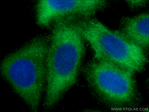 [17462-1-AP-20UL] Plasminogen Polyclonal antibody