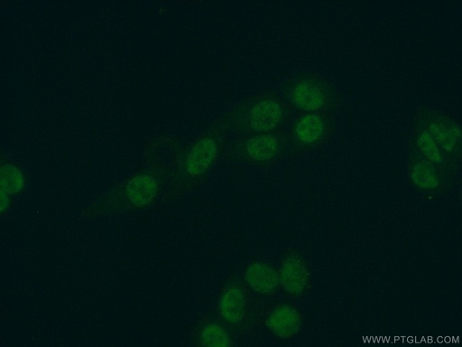 [17466-1-AP-20UL] SKAR Polyclonal antibody