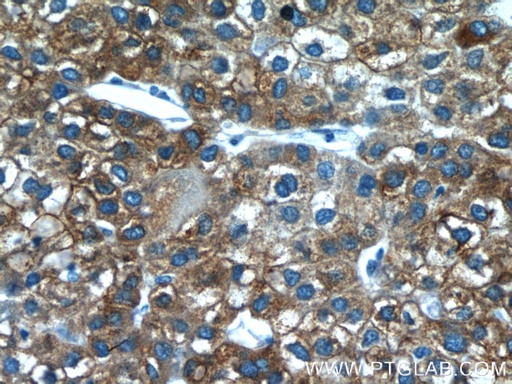 [17469-1-AP-150UL] FMO3 Polyclonal antibody