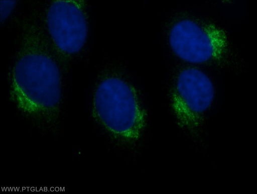 [17470-1-AP-150UL] CLUAP1 Polyclonal antibody
