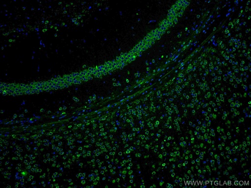 [17479-1-AP-150UL] YTHDF1 Polyclonal antibody