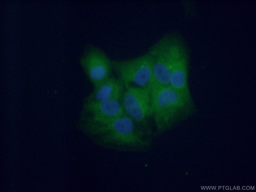[17480-1-AP-20UL] DTD1 Polyclonal antibody