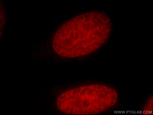 [17485-1-AP-20UL] PDS5A Polyclonal antibody