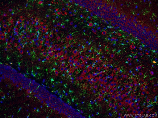 [17490-1-AP-20UL] MAP2 Polyclonal antibody