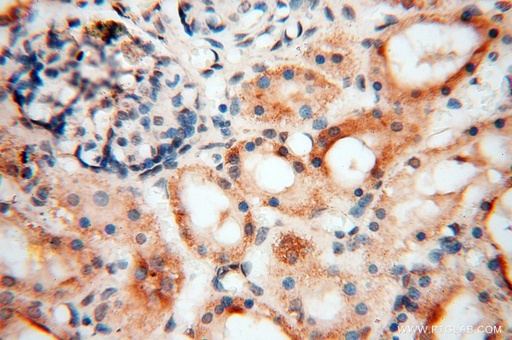 [17491-1-AP-20UL] USP20 Polyclonal antibody