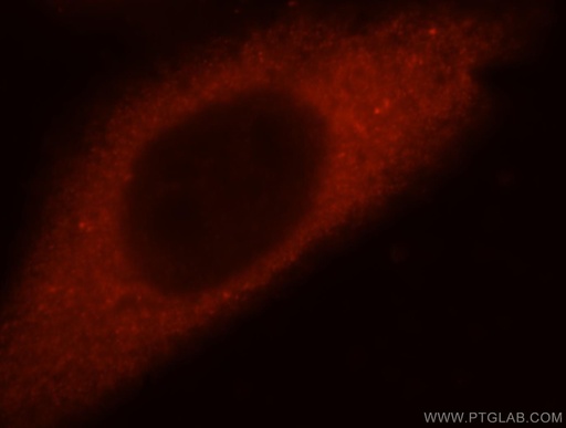 [17492-1-AP-20UL] Filensin Polyclonal antibody