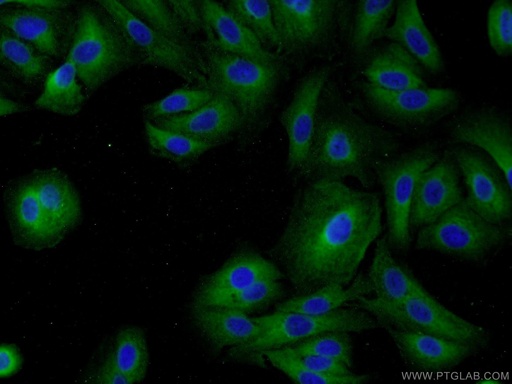 [17494-1-AP-20UL] MAGEB18 Polyclonal antibody