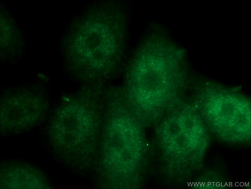 [17495-1-AP-20UL] SPAG4L Polyclonal antibody