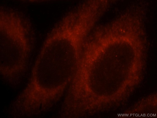 [17499-1-AP-20UL] MYO1A Polyclonal antibody