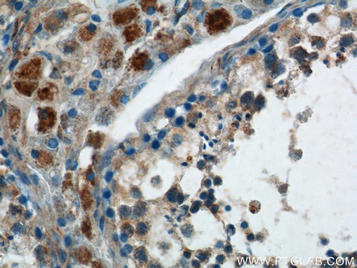 [17500-1-AP-20UL] SPATA3 Polyclonal antibody