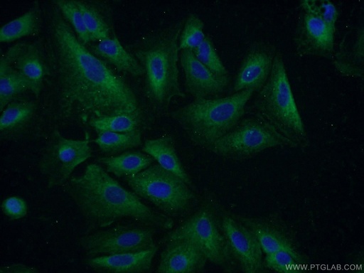 [17502-1-AP-20UL] GSTCD Polyclonal antibody