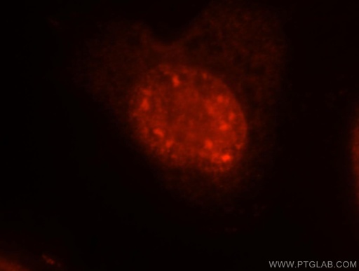 [17504-1-AP-20UL] EIF4A3 Polyclonal antibody