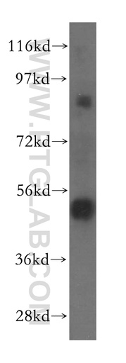[17506-1-AP-150UL] TOM1 Polyclonal antibody