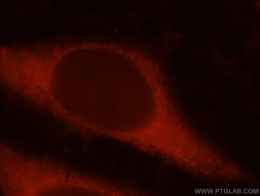 [17507-1-AP-150UL] RAI14 Polyclonal antibody