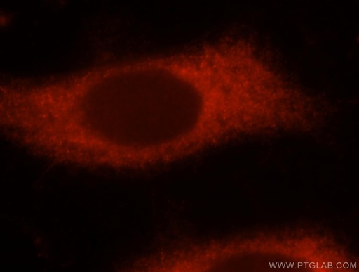 [17508-1-AP-20UL] NUDT3/4/10/11 Polyclonal antibody