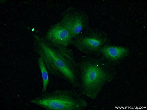 [17509-1-AP-20UL] IRS1 Polyclonal antibody