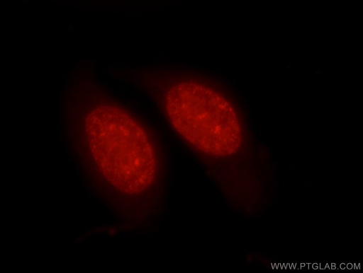 [17510-1-AP-20UL] Histone H1.0 Polyclonal antibody
