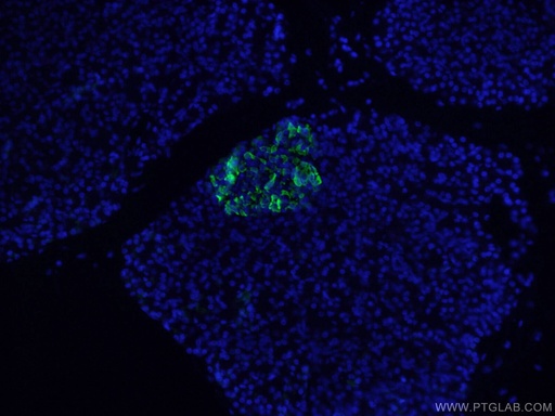 [17512-1-AP-150UL] Somatostatin (64-81aa) Polyclonal antibody