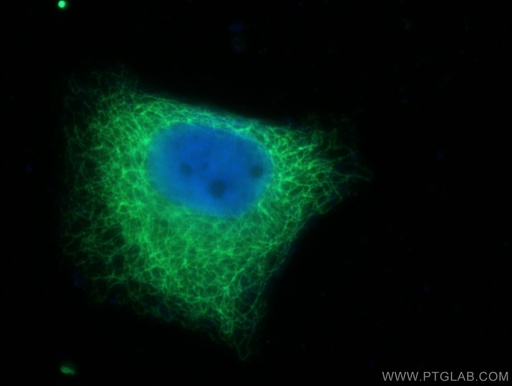 [17513-1-AP-20UL] Cytokeratin 7-specific Polyclonal antibody