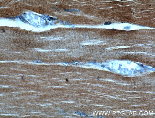 [17521-1-AP-150UL] ACTA1-Specific Polyclonal antibody