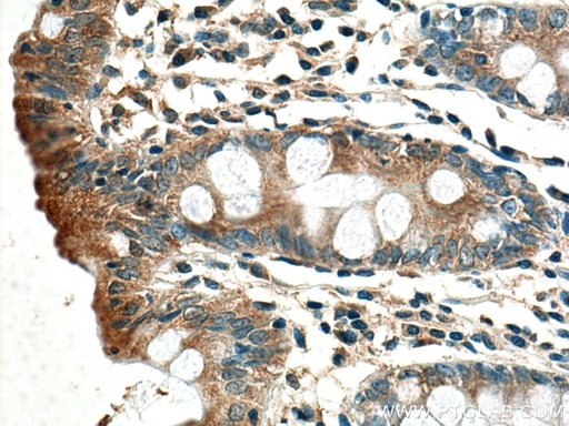 [17526-1-AP-150UL] ACADL-Specific Polyclonal antibody