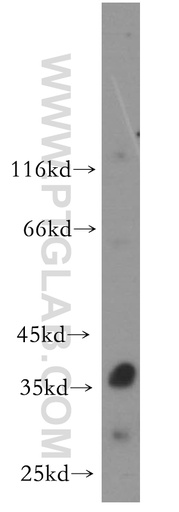 [17527-1-AP-150UL] RNASEH2B Polyclonal antibody