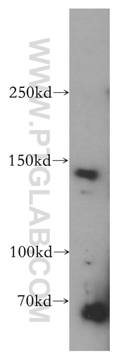 [17530-1-AP-150UL] POLR3A Polyclonal antibody