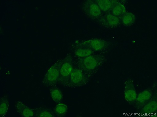 [17532-1-AP-20UL] CTDSPL2 Polyclonal antibody