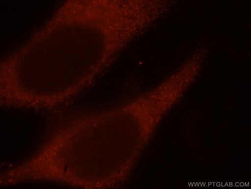 [17534-1-AP-20UL] IFT52 Polyclonal antibody