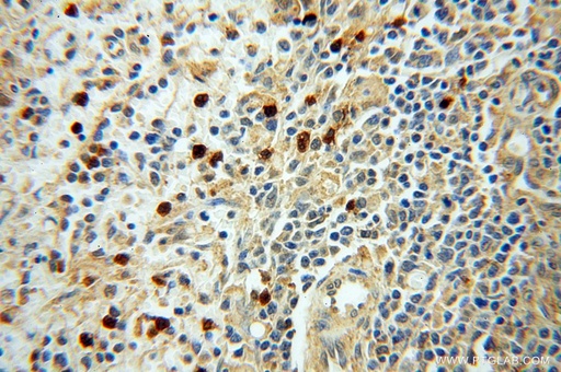 [17535-1-AP-150UL] PARP9 Polyclonal antibody