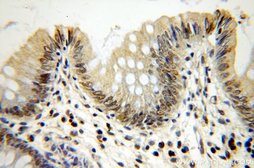 [17554-1-AP-150UL] MTA2 Polyclonal antibody