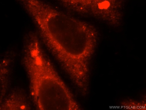 [17555-1-AP-150UL] TRMT11 Polyclonal antibody