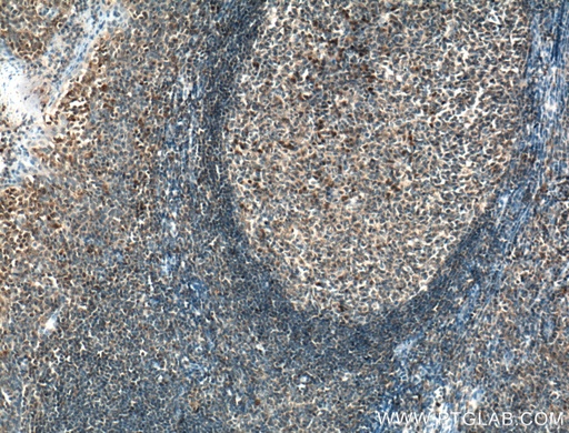 [17558-1-AP-20UL] WDFY4 Polyclonal antibody