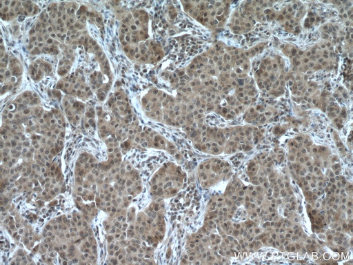 [17559-1-AP-150UL] RMND5A Polyclonal antibody