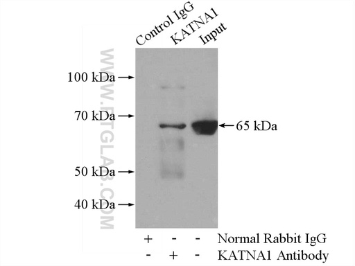 [17560-1-AP-150UL] KATNA1 Polyclonal antibody
