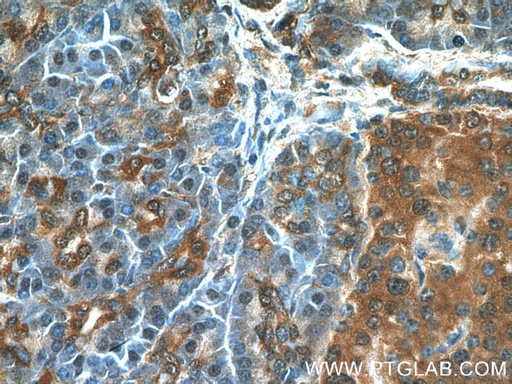 [17563-1-AP-150UL] RIP3 Polyclonal antibody