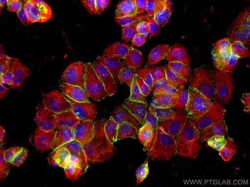 [17565-1-AP-150UL] Beta Catenin Polyclonal antibody