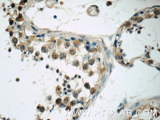 [17566-1-AP-150UL] TSGA14 Polyclonal antibody