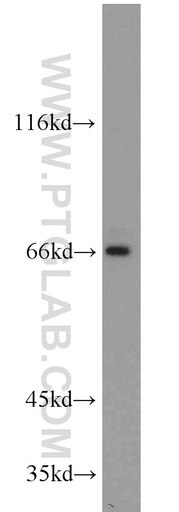 [17568-1-AP-20UL] PLEKHA9 Polyclonal antibody