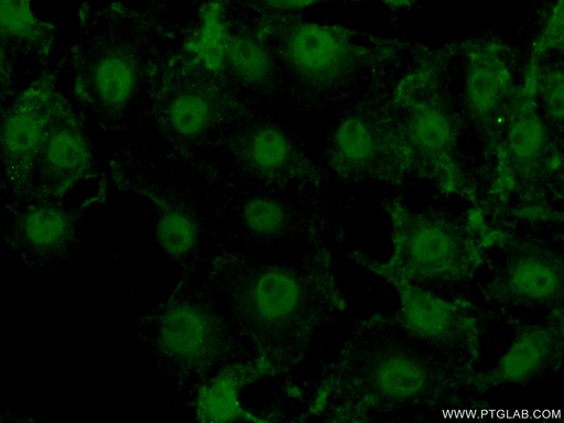 [17570-1-AP-20UL] ACAP3 Polyclonal antibody