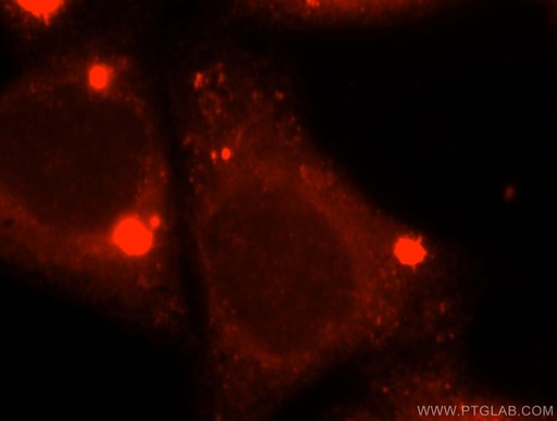 [17571-1-AP-150UL] ACOX2 Polyclonal antibody