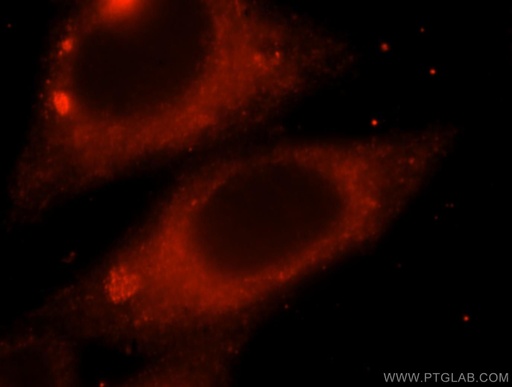 [17572-1-AP-20UL] MAPK10 Polyclonal antibody