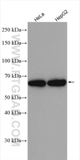 [17573-1-AP-150UL] THNSL2 Polyclonal antibody