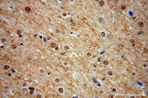 [17575-1-AP-150UL] MDM1 Polyclonal antibody
