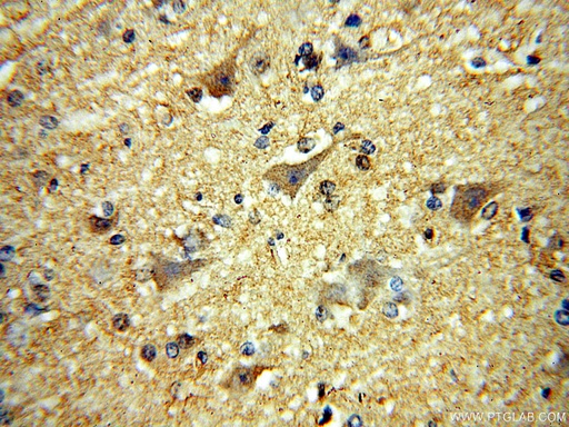 [17578-1-AP-150UL] MCTP2 Polyclonal antibody