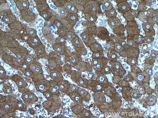 [17580-1-AP-20UL] PKLR Polyclonal antibody